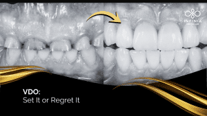Vertical Dimension of Occlusion